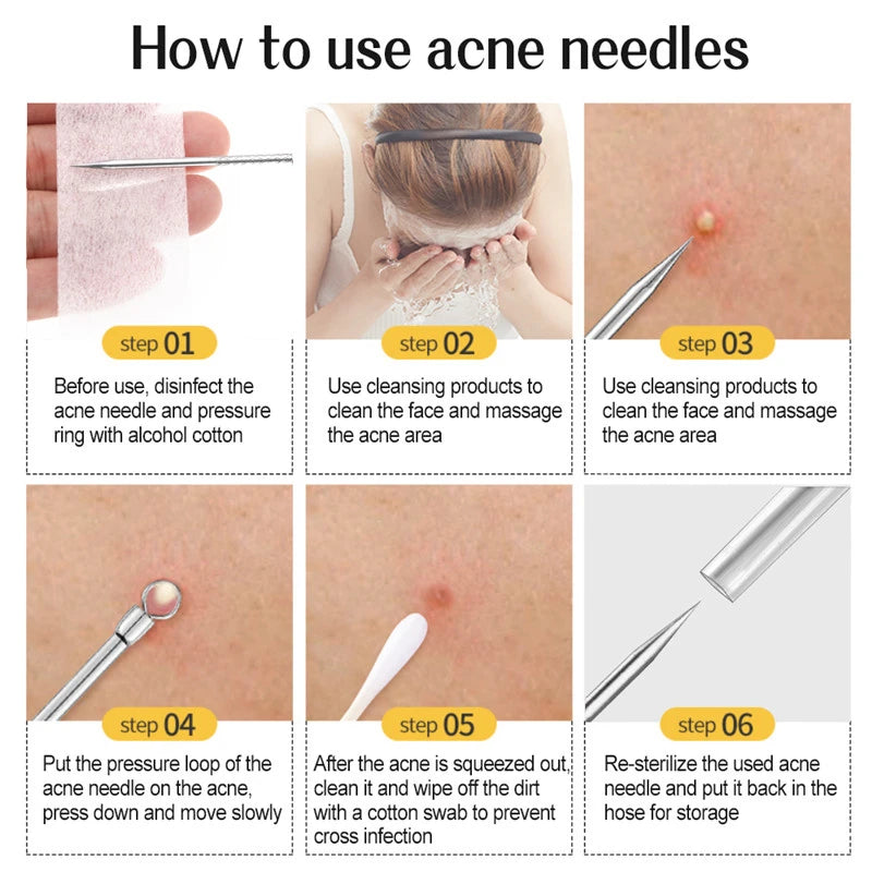 11Pcs/Set Acne Needle Blackhead Clip Remover Extraction Pore Black Head Cleaner Face Skin Care Cleansing Needle Tool Cell Clamp